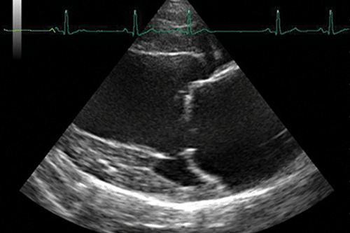 1334 - Introduction to Cardiac Ultrasound