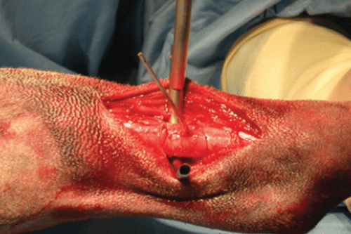 surgical image showing atraumatic cerclage wire placement to illustrate the skills that will be gained on this small animal orthopaedics CPD course from CPD Solutions