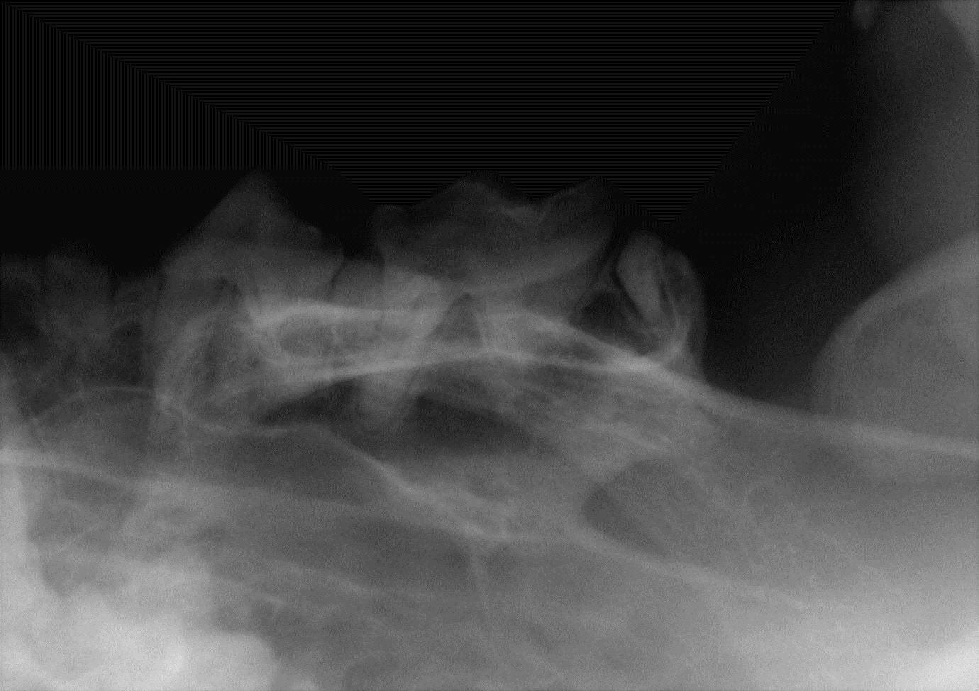 Ultimate Dental XRay Q2 CPD Solutions Course Info