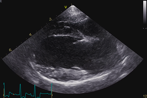 Advance25-Cardiac-Ultrasound