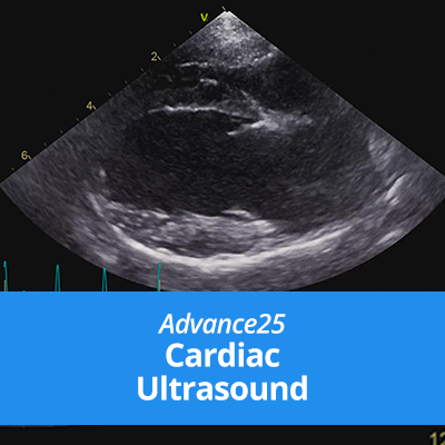 A25-Cardiac-Ultrasound