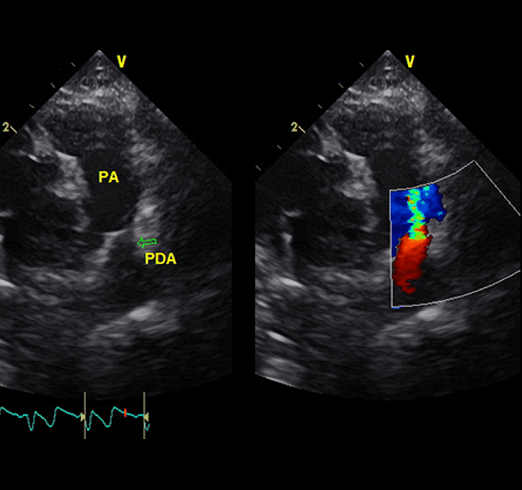 Practical-Cardiac-Ultrasound-Level-2-SQ