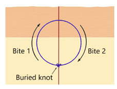 Intradermal Pattern Surgical Skills for Nurses Attendance Course Q1 CPD Solutions Course ...