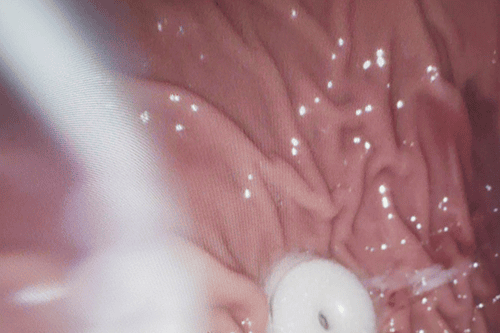 Advanced-Practical-Endoscopy-S1-1-e1784207614875.png