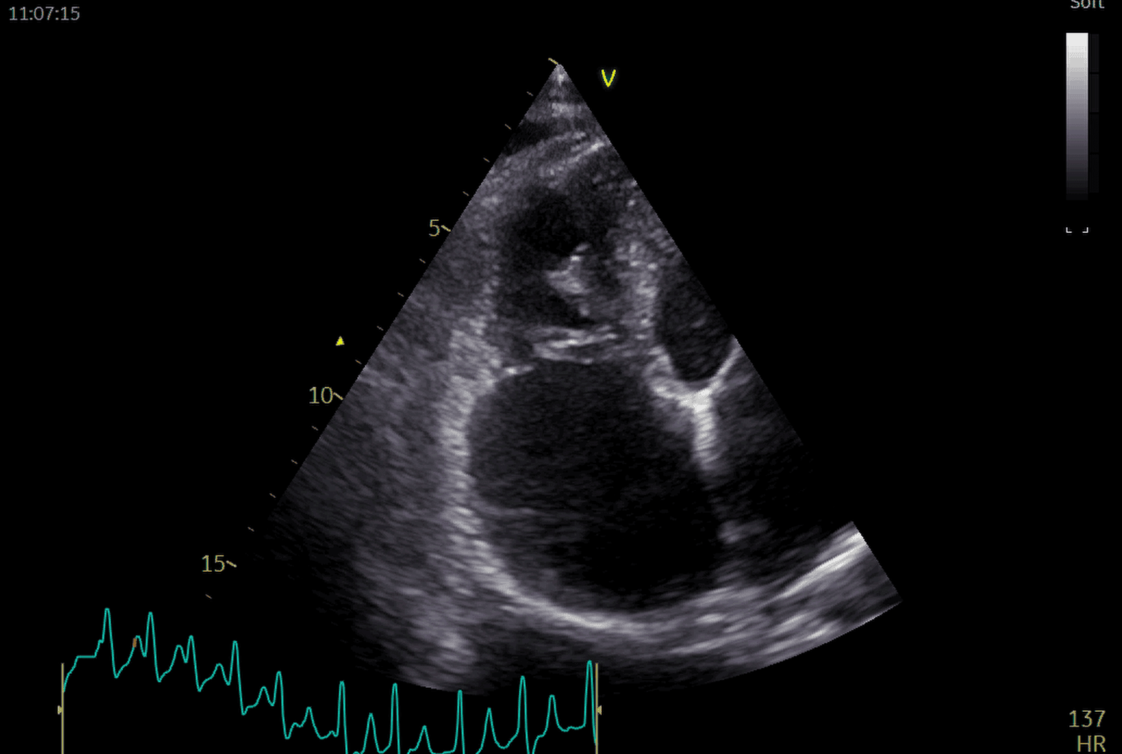 clinical impact cardiology page image
