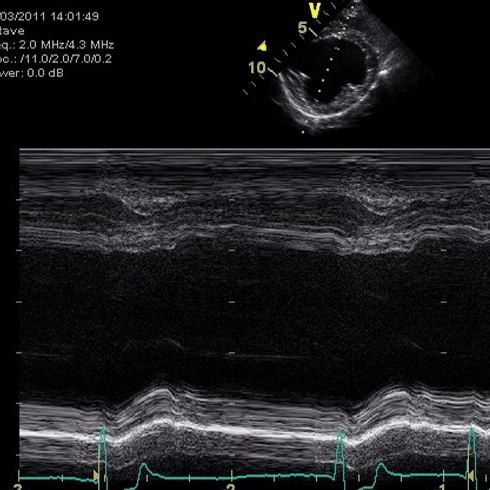 Practical-Cardiac-Ultrasound-Scanning-Day-SQ