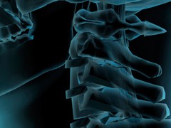 human neck radiographic image